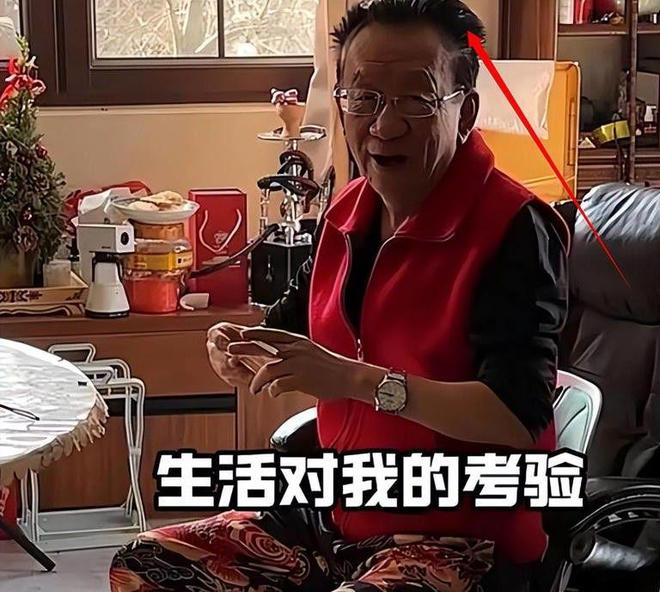 一医院用猪猪侠表情包引导患者瞪眼，走红网络！网友：太超前了